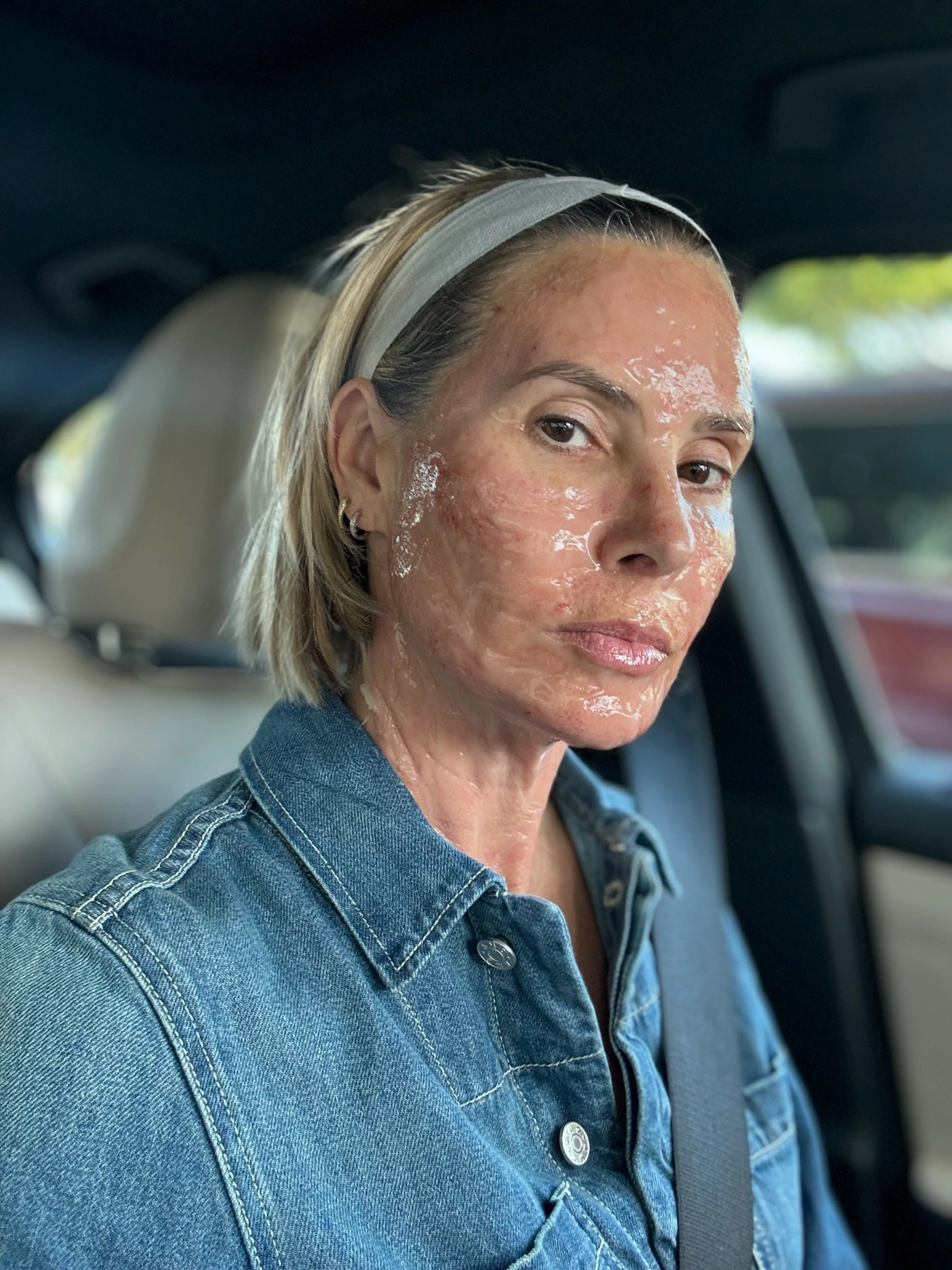 Microneedling — Female Treatment Sequence