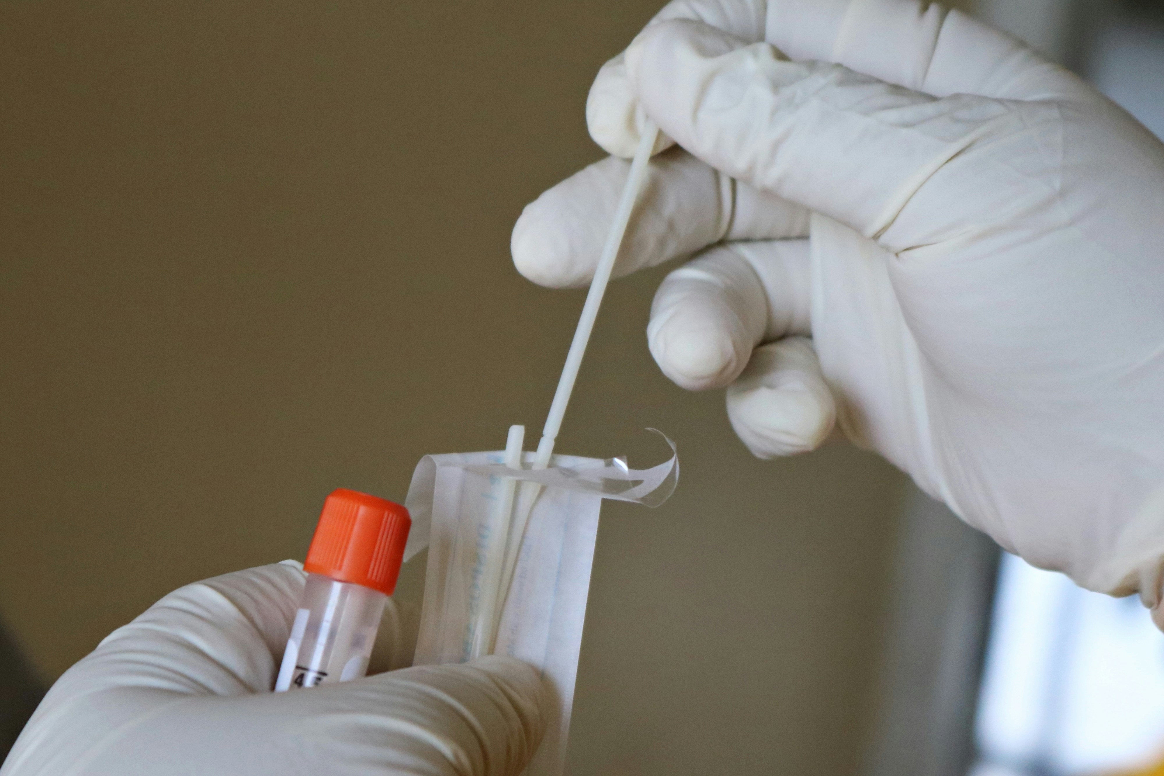 Blood testing equipment being used in a laboratory setting