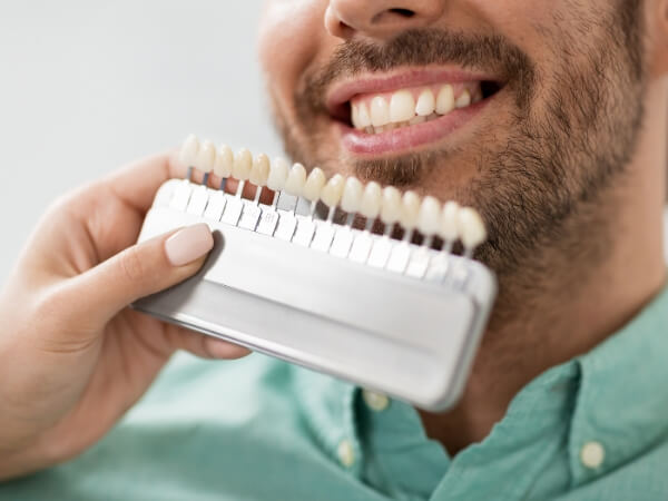 Tecnologia e expertise em facetas de resina
