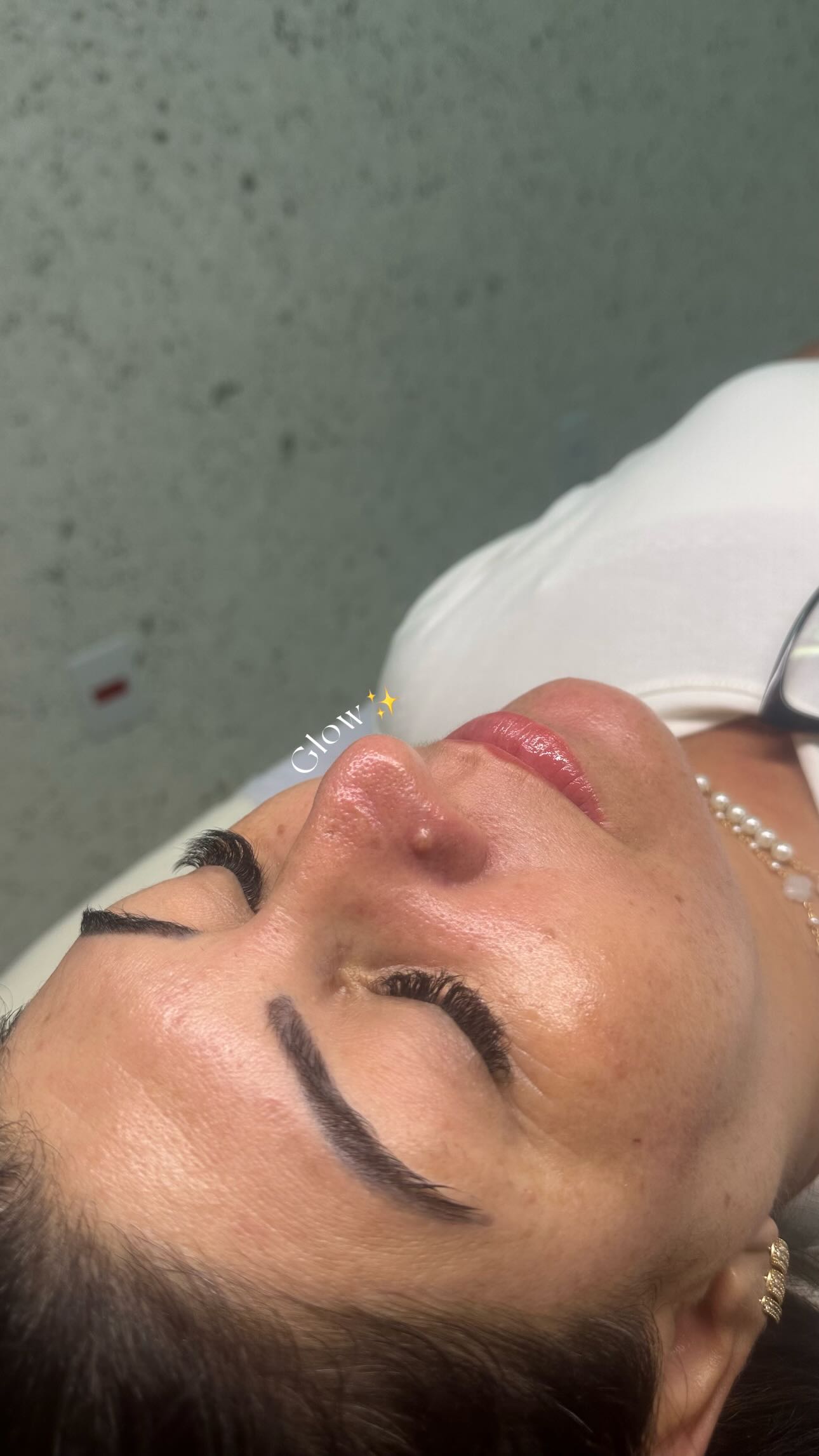 Resultado antes e depois 5