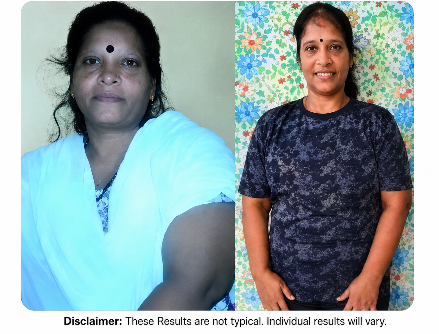 Lost 25 KG