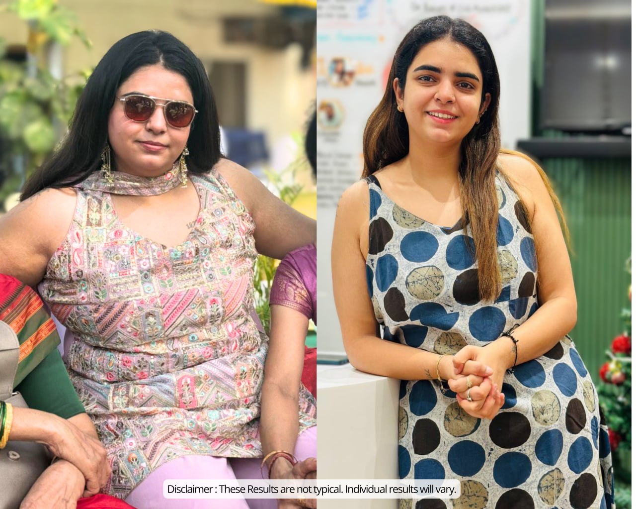 Lost 25 KG