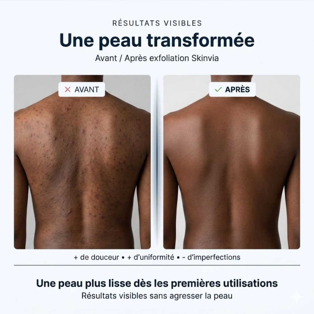 Résultats visibles - Une peau transformée, avant et après exfoliation SKINVIA