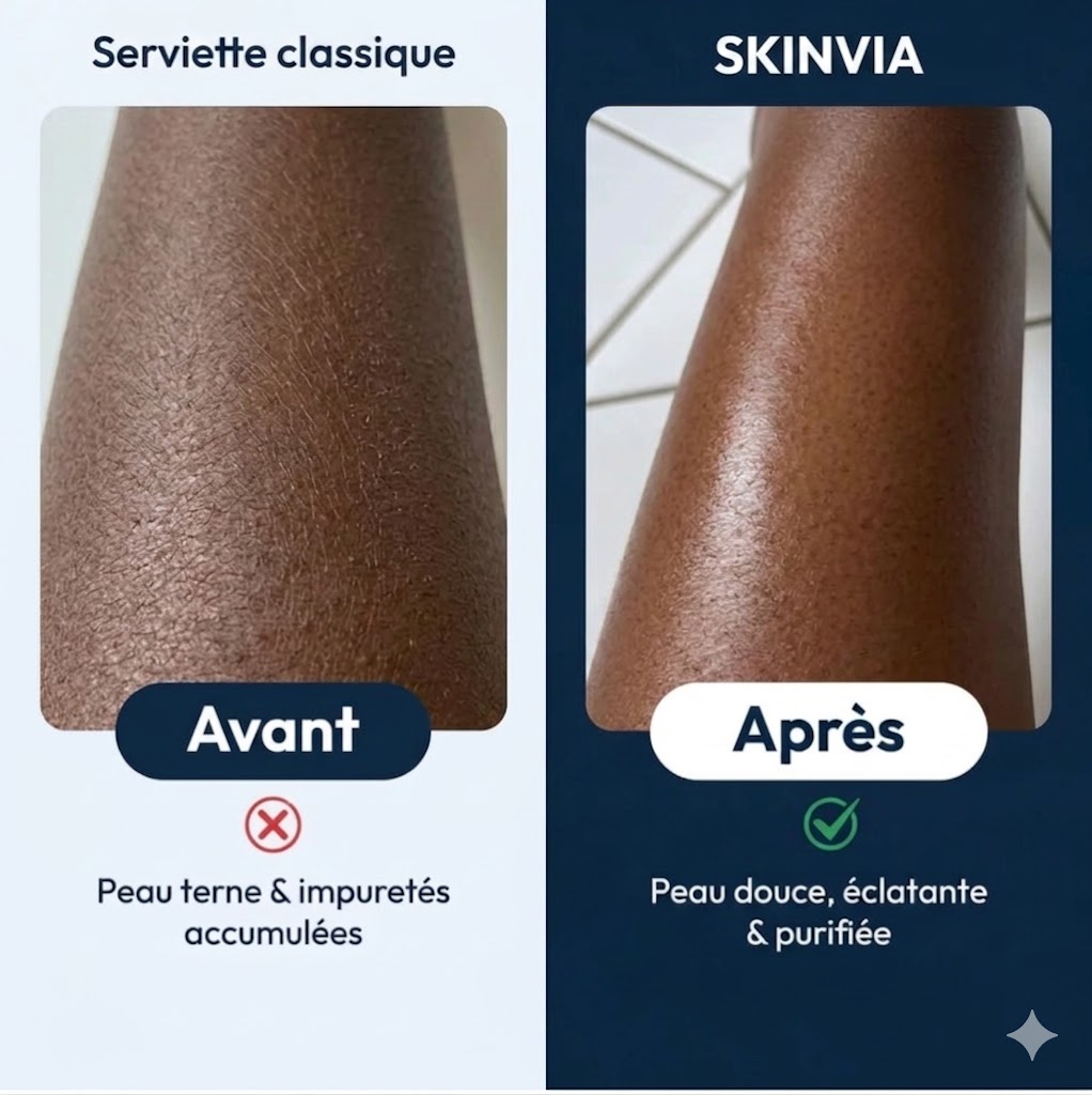Comparaison serviette classique et SKINVIA - peau douce et purifiée